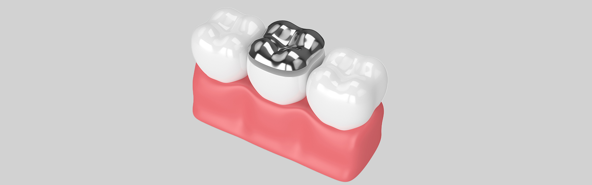 Dental Fillings in Jackson, MI | Tooth Filling