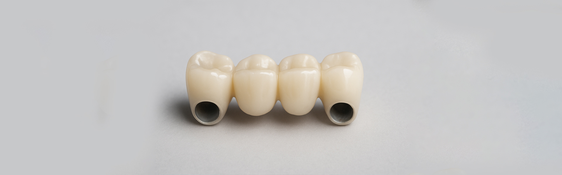 What Kind of Benefits Do You Get from Dental Bridge Treatment in Jackson
