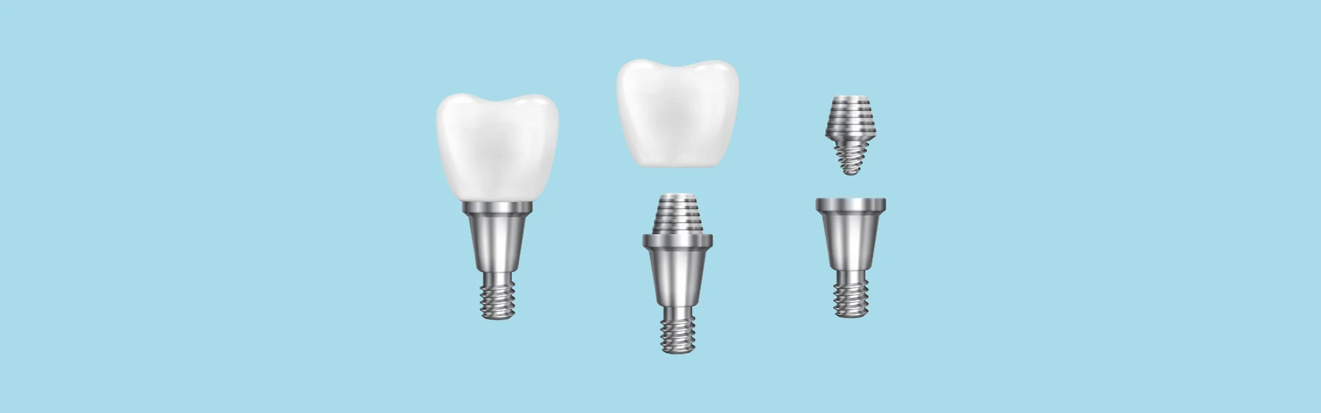 Top Questions Patients Ask About Cosmetic Dental Implants