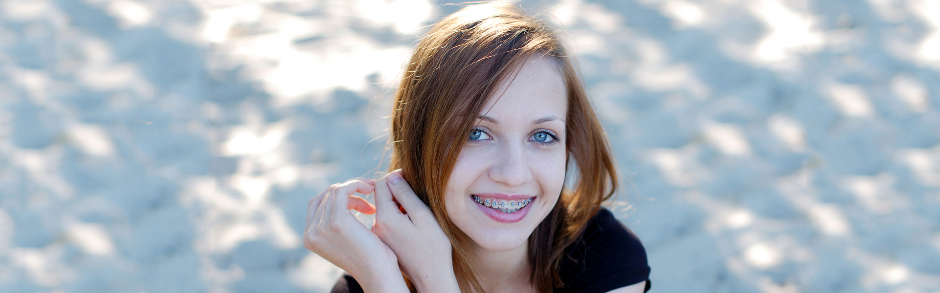 How Same Day Essex Retainers Protect Your Orthodontic Results?