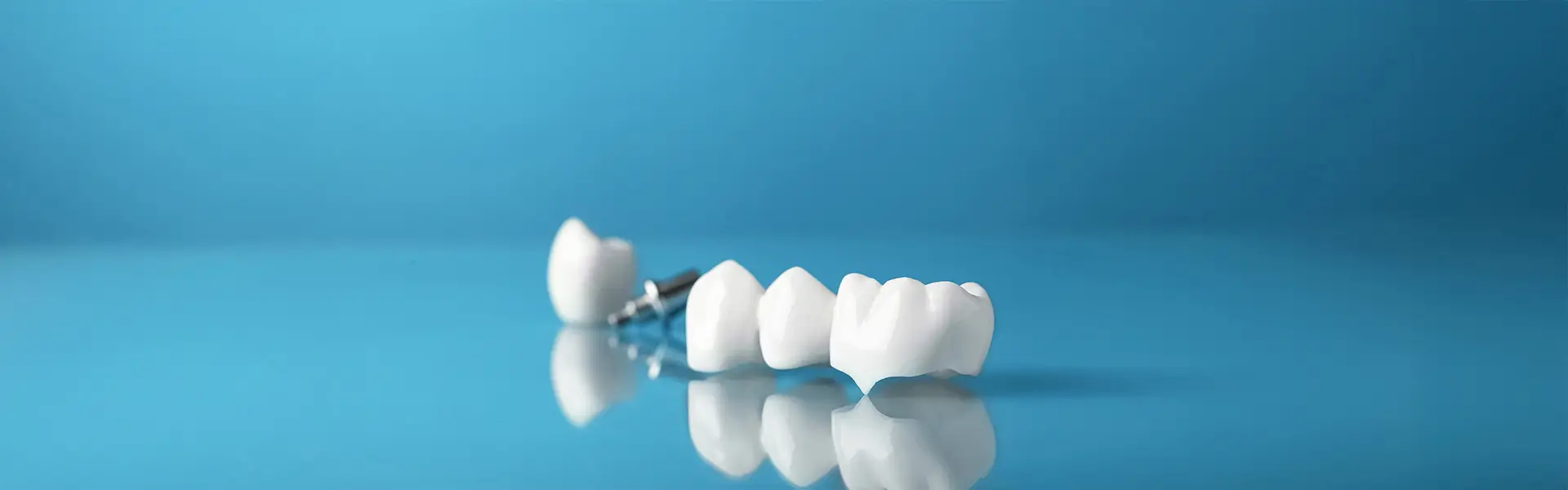 The Closest Path to a Perfect Smile: Top-Rated Crown Providers in Jackson